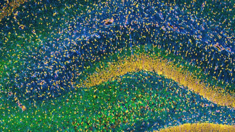 Scott Kanoski of HEB publishes an article in “Translational Psychiatry” showing a direct connection between gut bacteria and impaired brain function