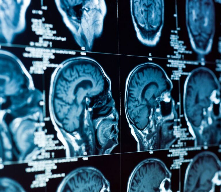 Brain imaging scans.