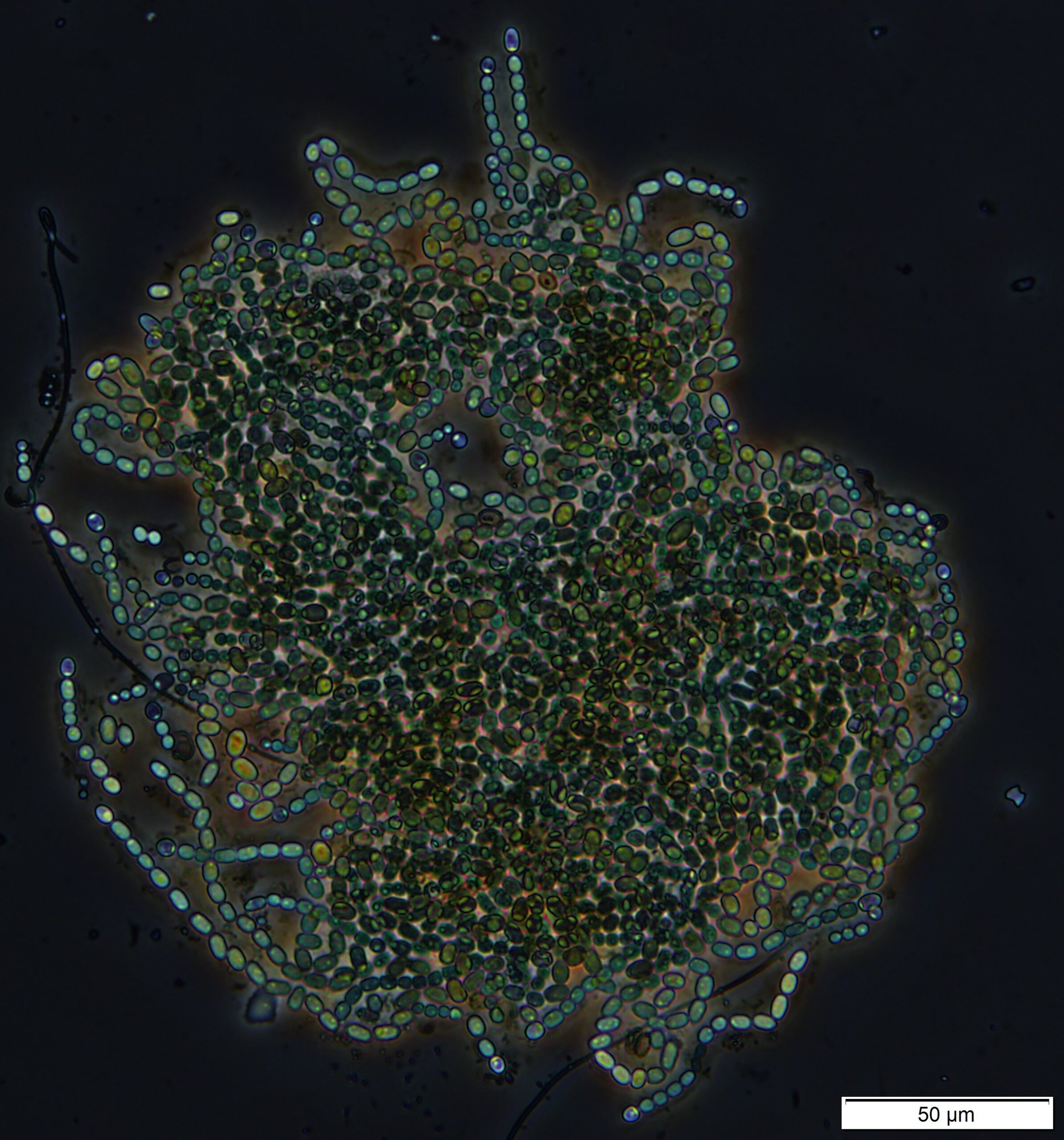 Nostoc - Colonies of filaments