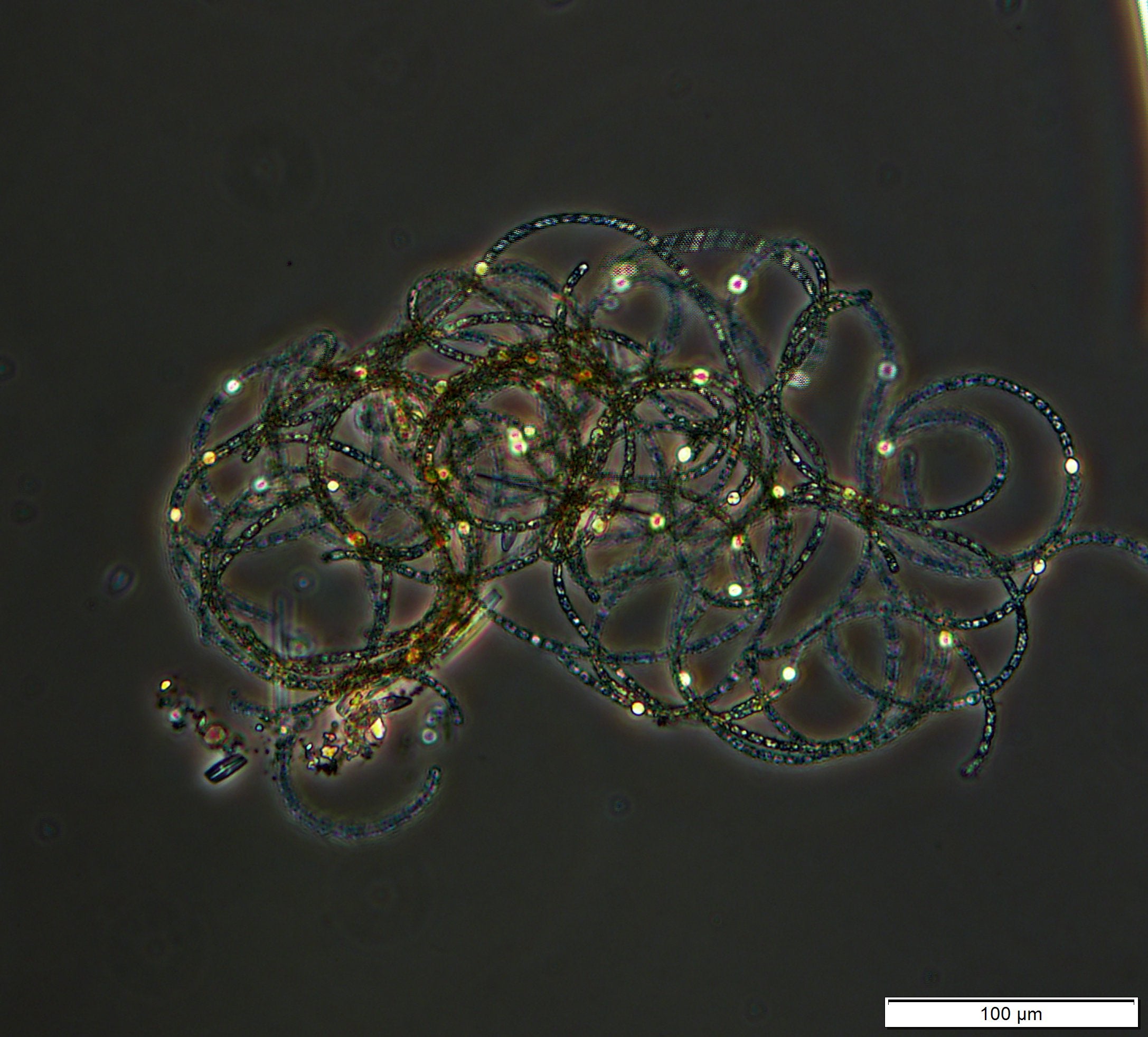 Dolichospermum - Cluster of filaments