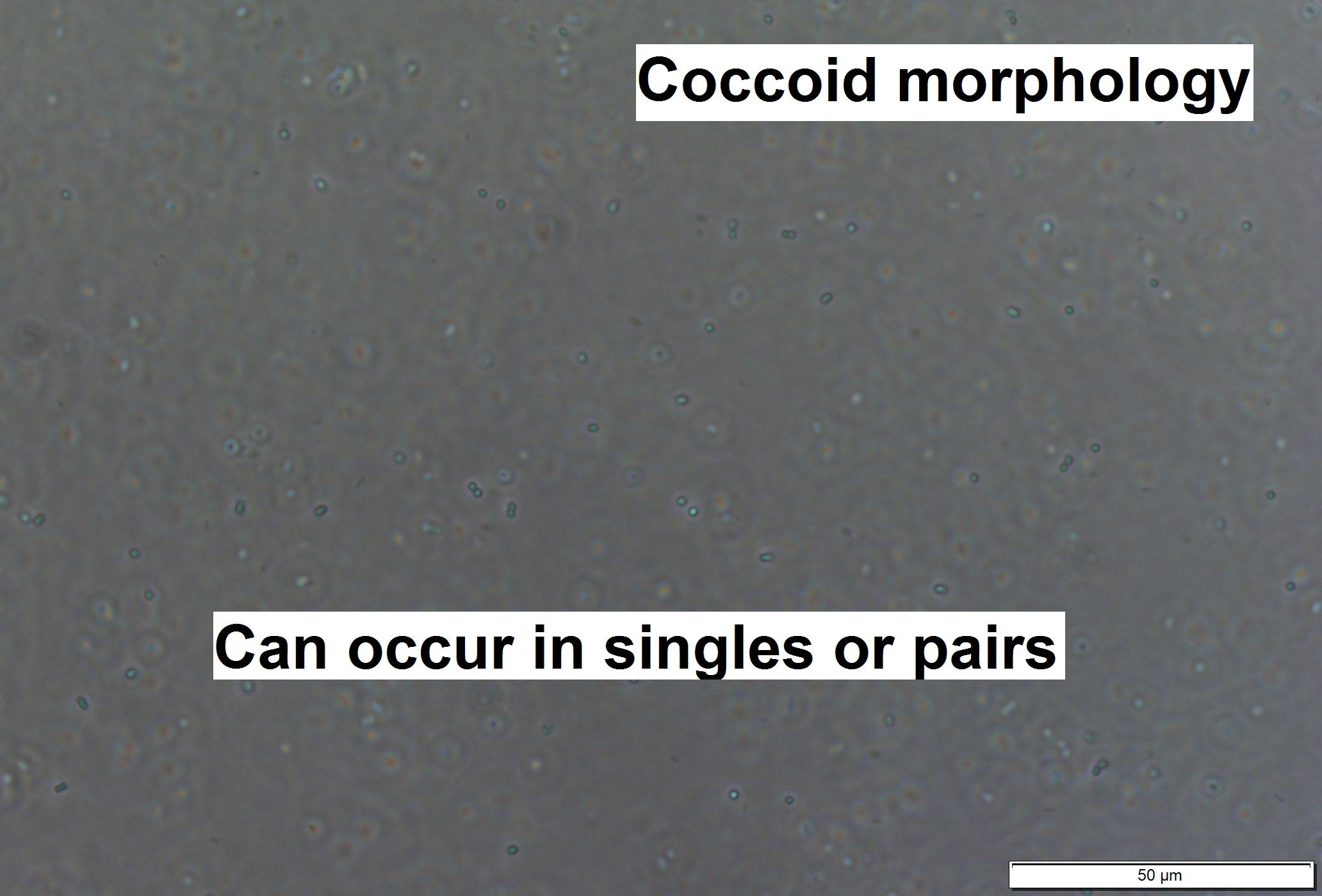 Cyanobium