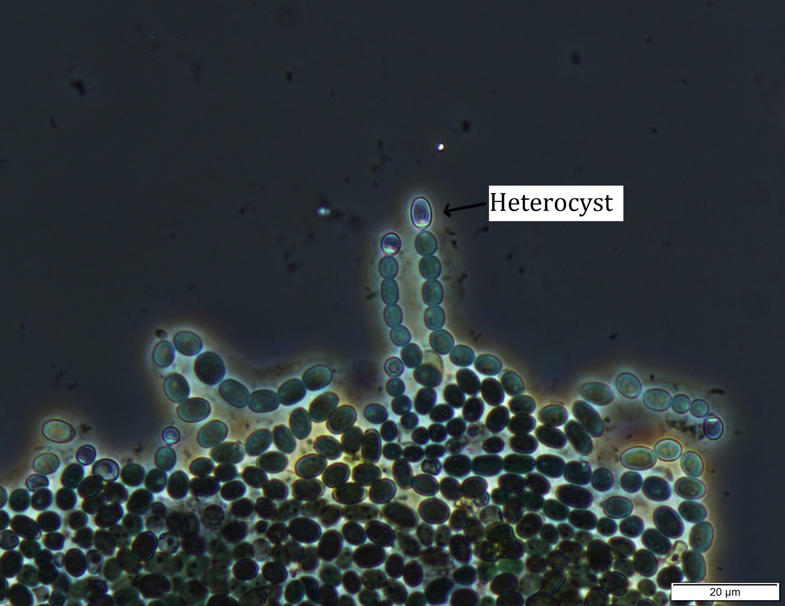 Nostoc - Colonies of filaments