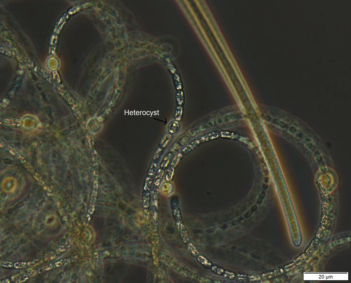 Dolichospermum - Cluster of filaments