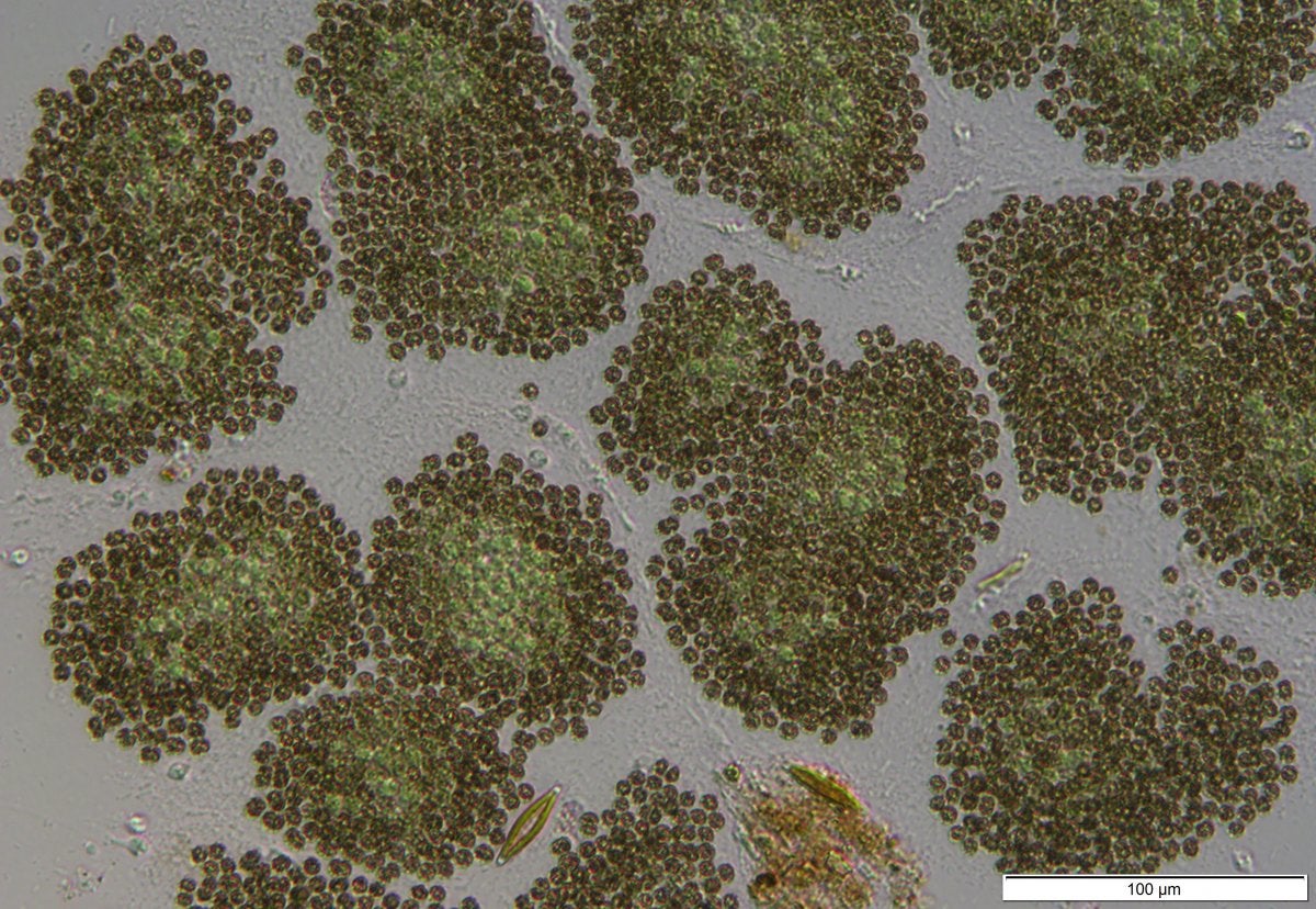 Microcystis - Colonies