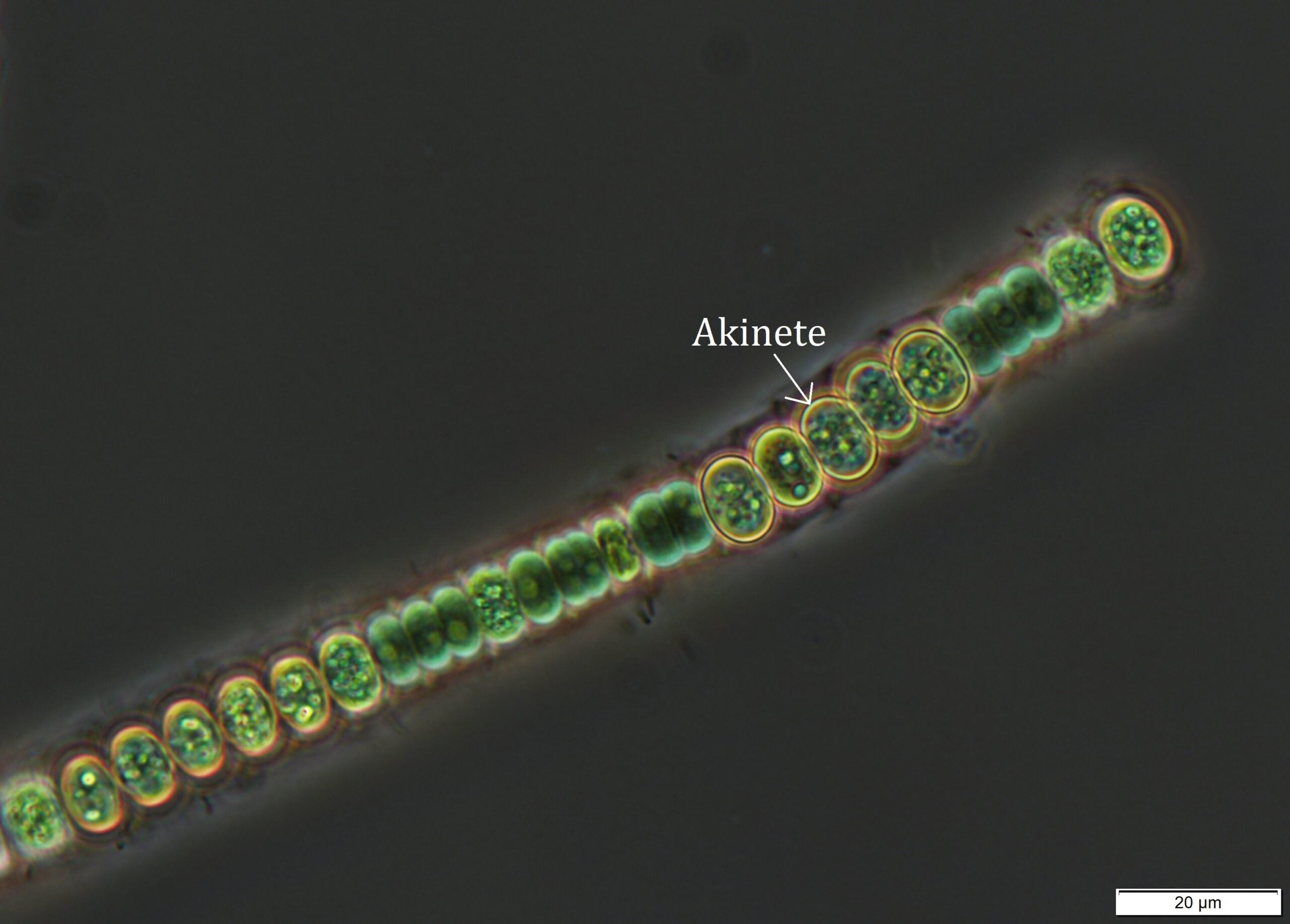 Nodularia