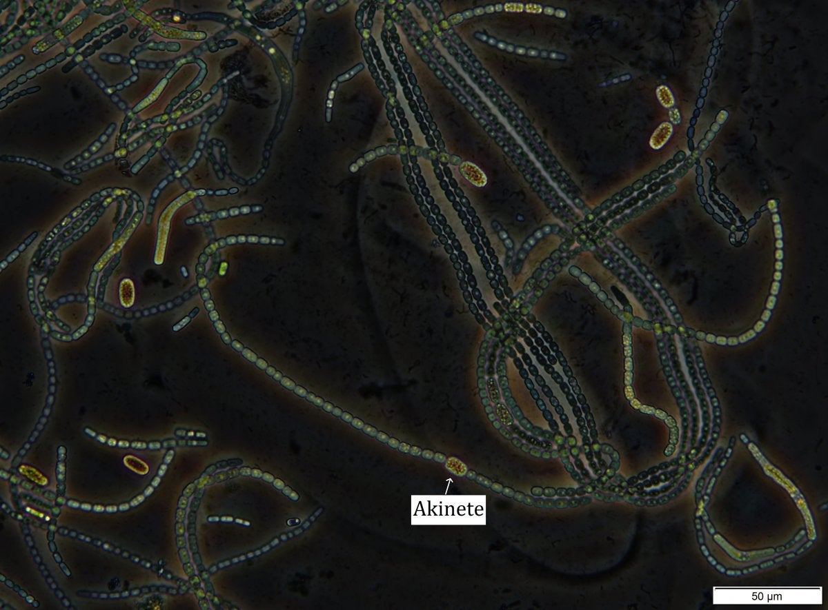 Nostoc - Colonies of filaments