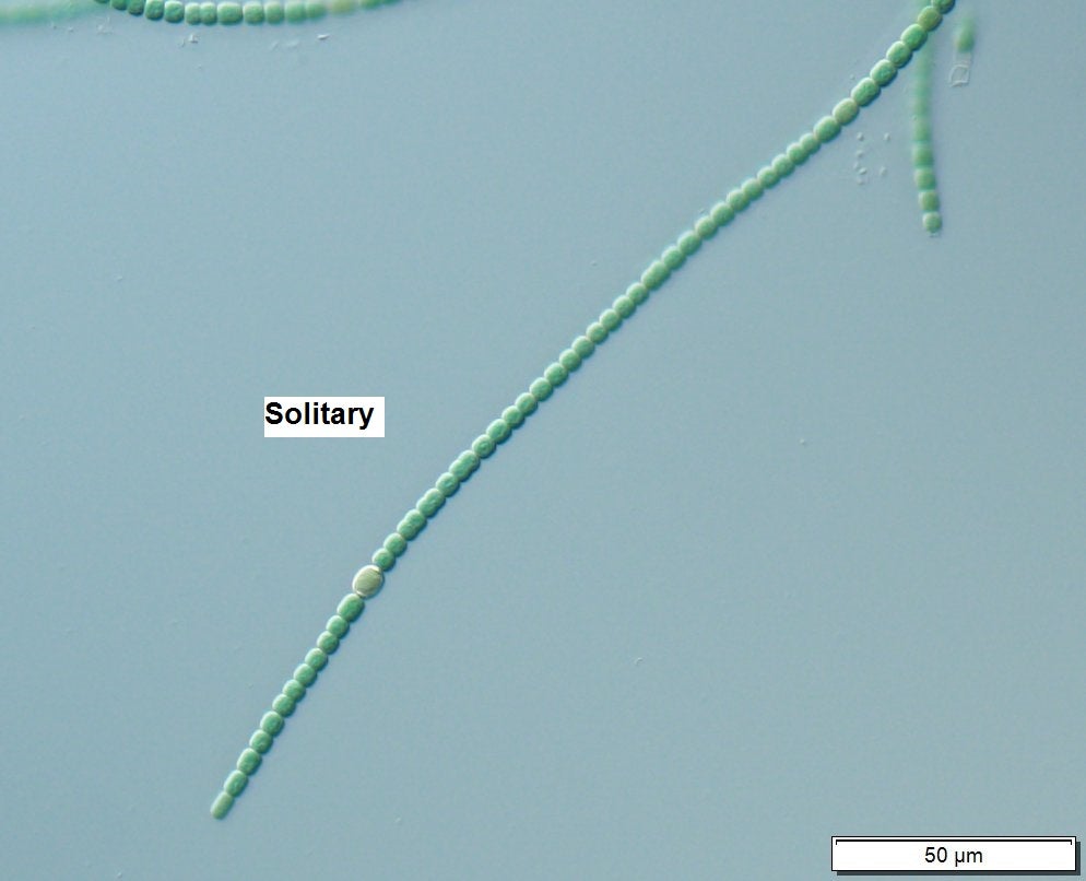 Anabaena - Solitary Filaments