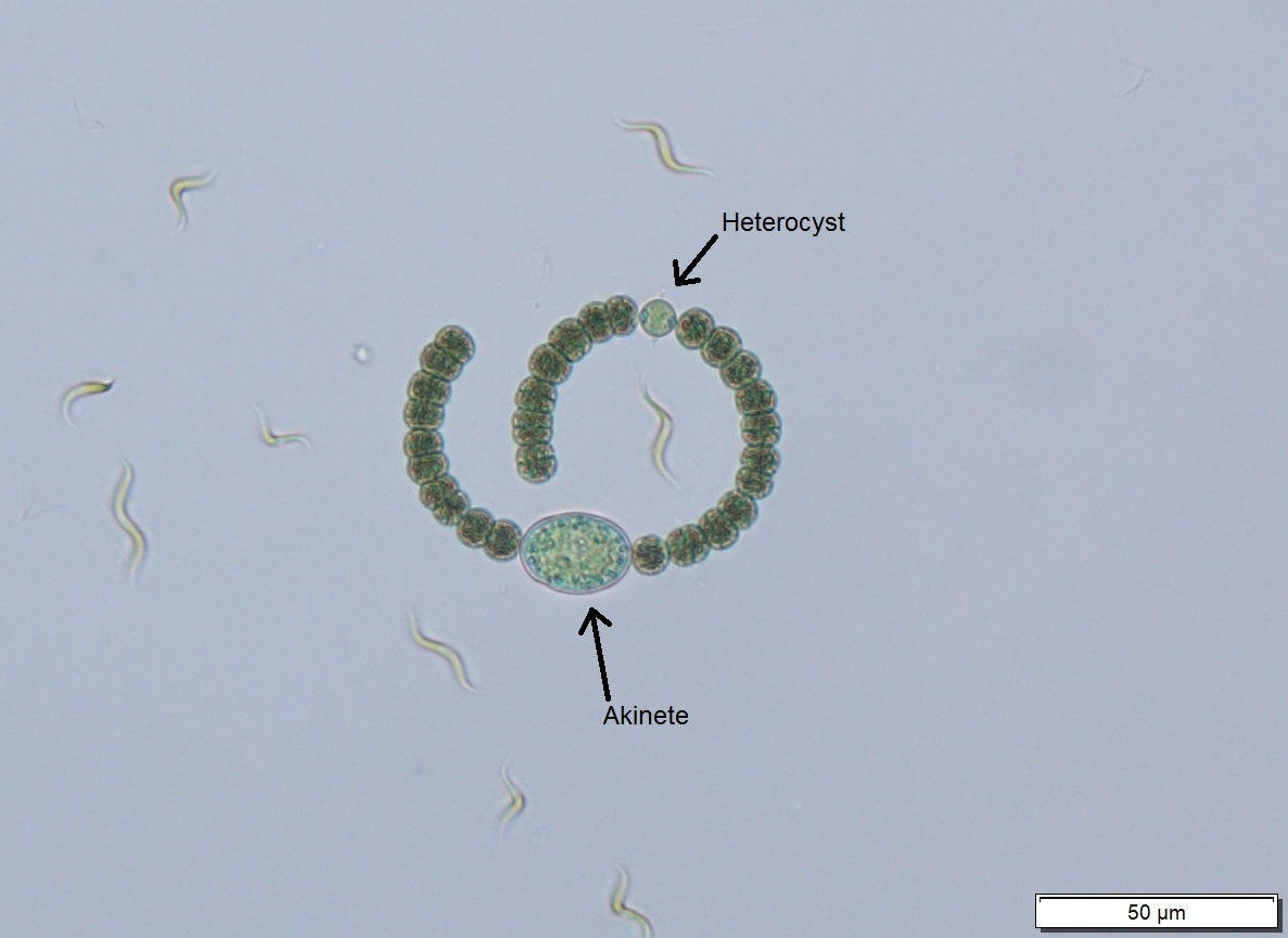 Dolichospermum - Singular filaments