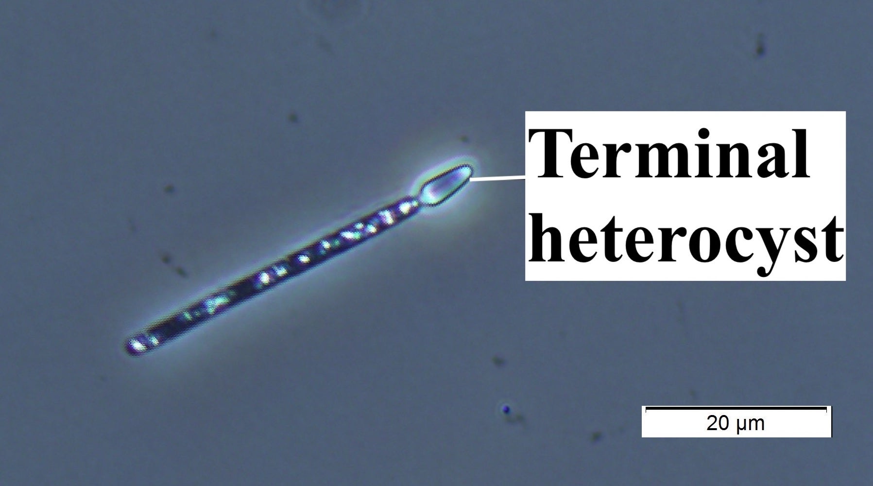 Cylindrospermopsis