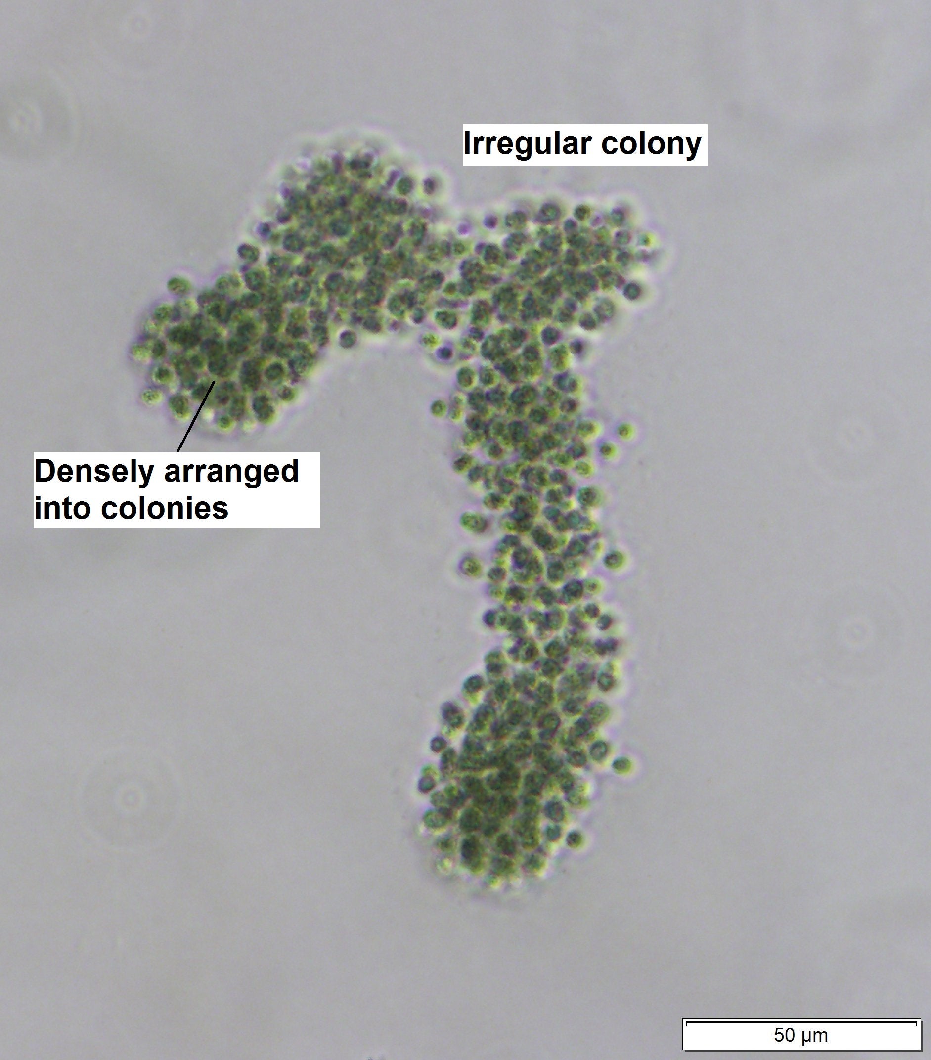 Microcystis - Colonies