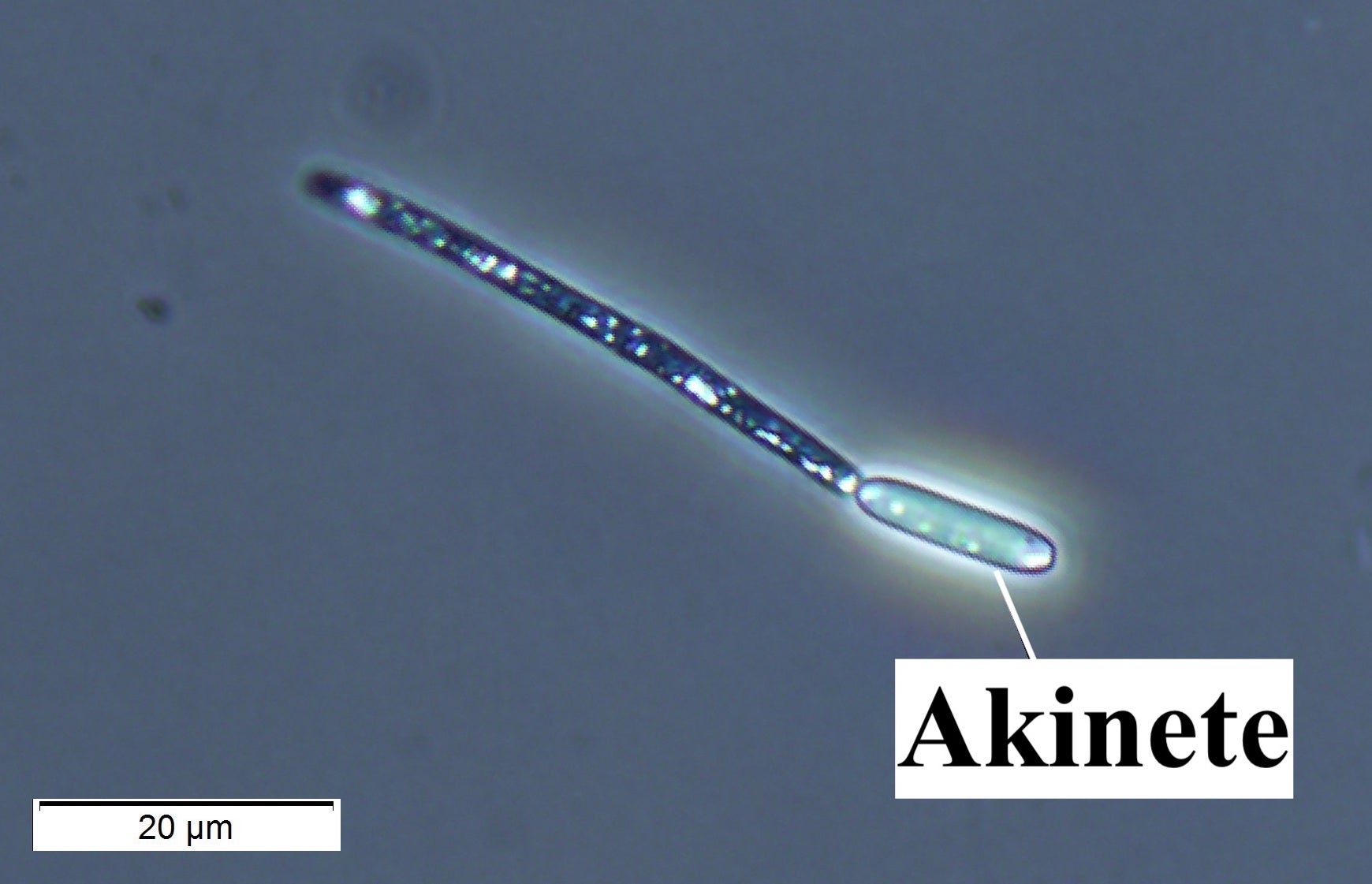 Cylindrospermopsis