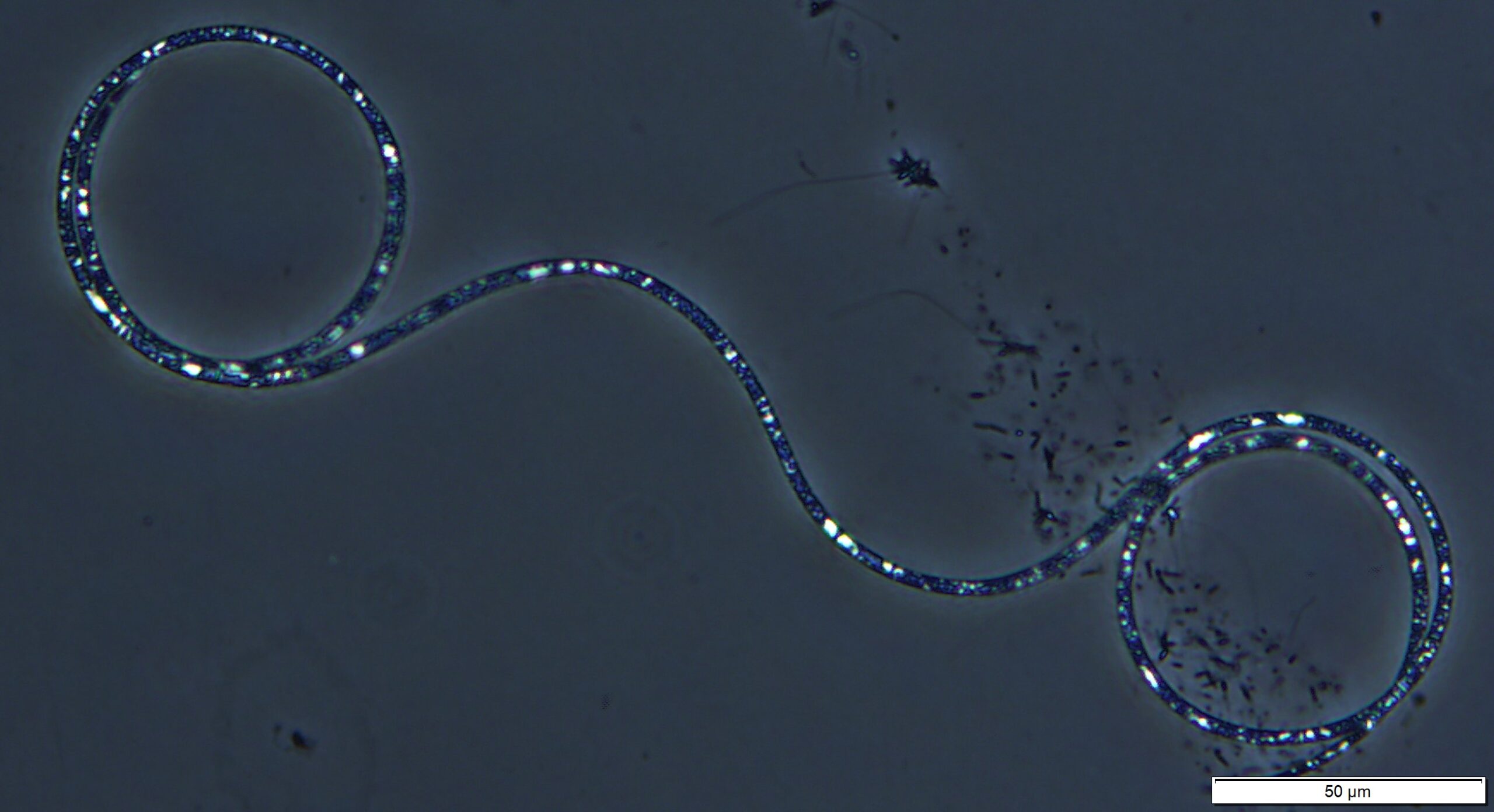 Cylindrospermopsis - Coiled morphology