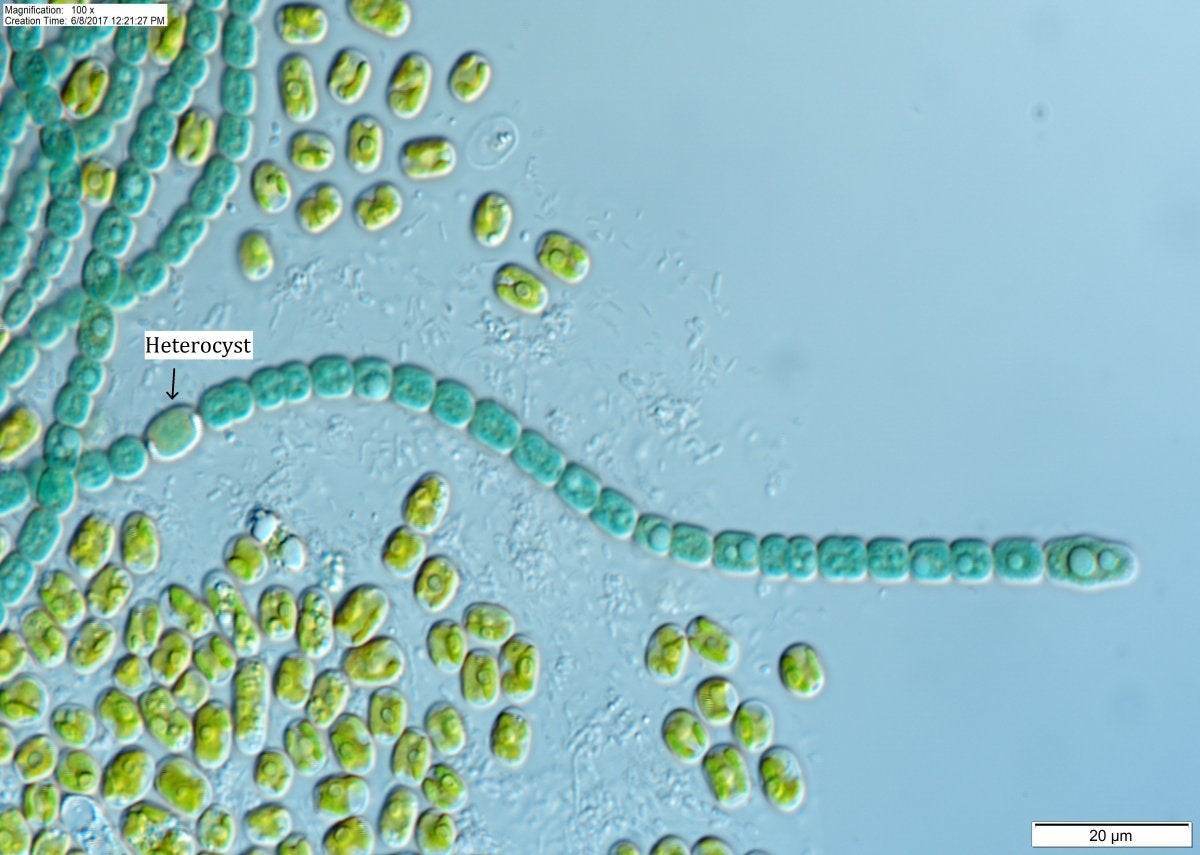 Nostoc - Colonies of filaments