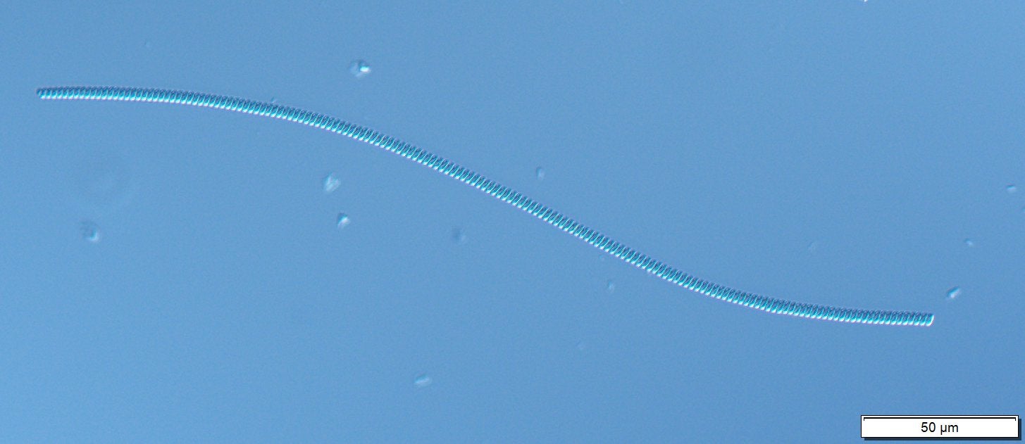 Spirulina - Solitary filaments