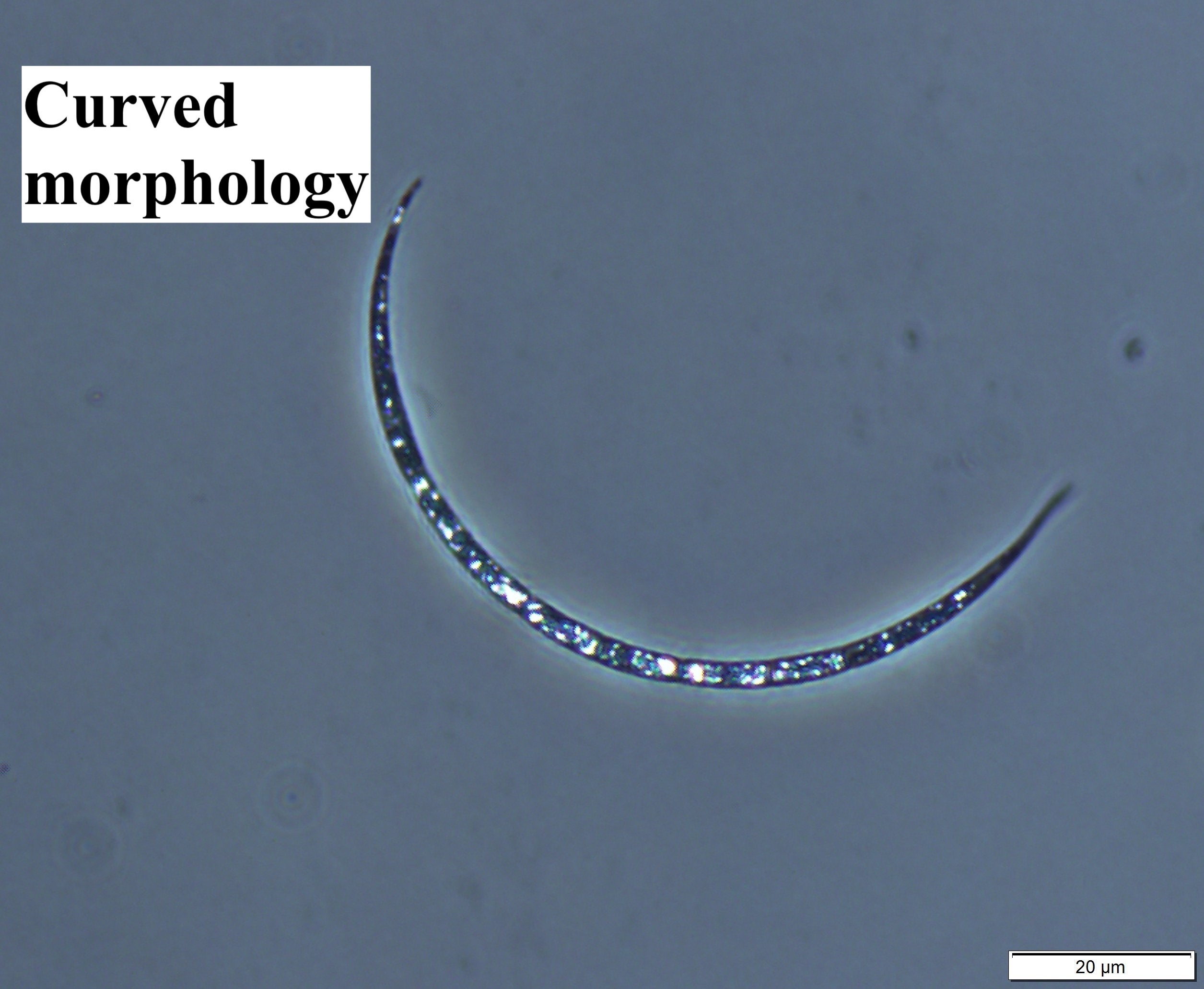 Cylindrospermopsis