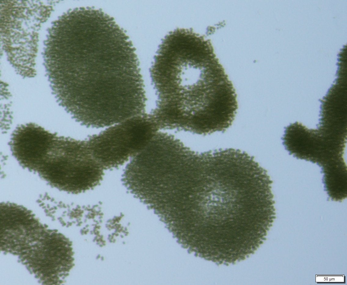 Microcystis - Colonies