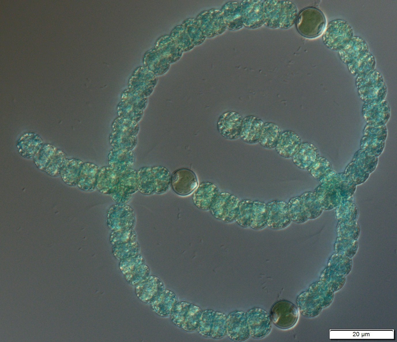 Dolichospermum - Singular filaments