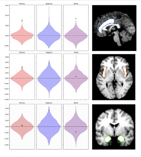 A series of violin plots and brain scans associated with a neuroscience study. The left section shows three rows of violin plots labeled Positive, Negative, and Mixed, representing data distributions for each emotion category. On the right, there are brain images highlighting specific areas of brain activity.