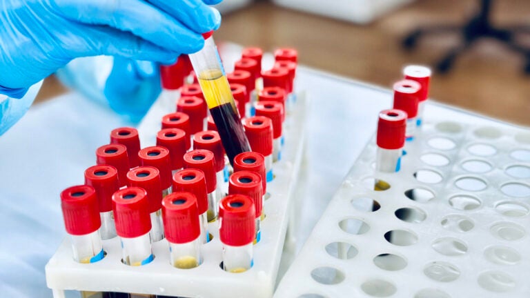 A gloved hand inserts vials of blood into a rack on a lab bench