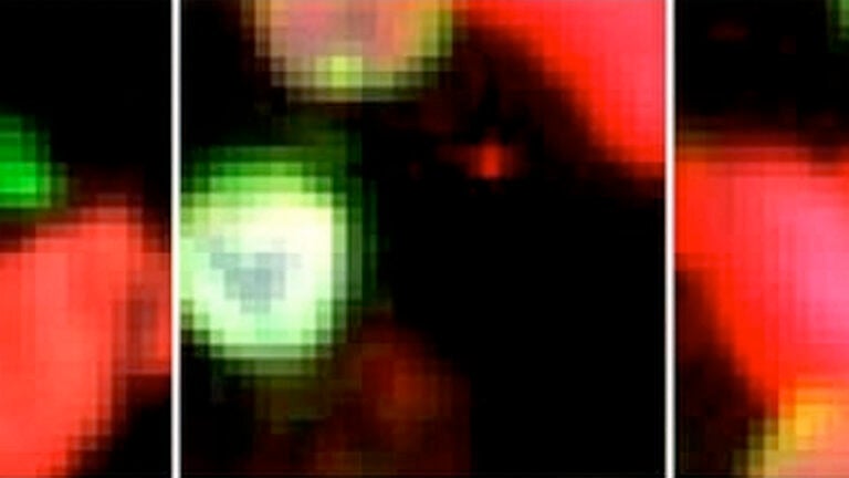 Digital image of cancer-associated cells