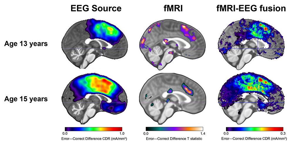 Scientific images of a brain at two different ages