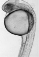 A microscopic image of a zebrafish larva