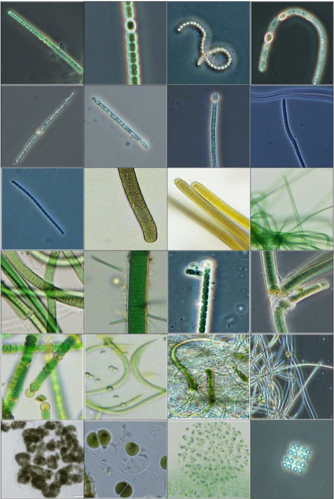 Microscopic picture of cyanobacterial species found in samples within this study.