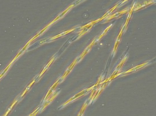Pseudo-nitzschia australis under the microscope