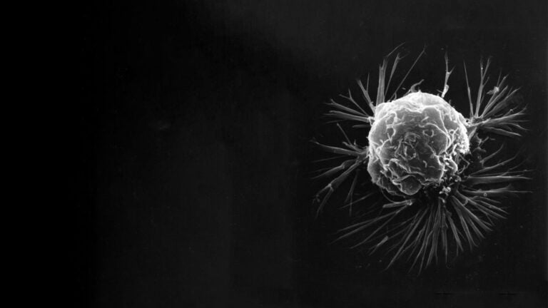Black and white image of a cancer cell.